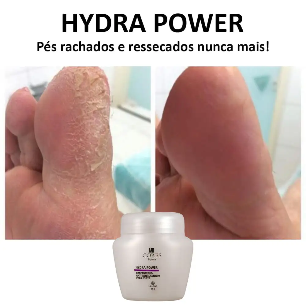 concentrado-anti-ressecamento-para-pes-hidra-power-corps-lignea-55g-4.webp